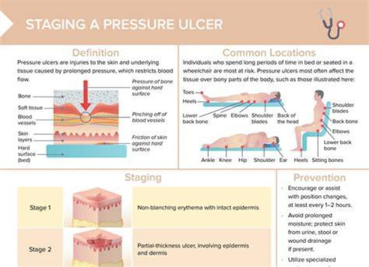Do ulcers hurt when you move?