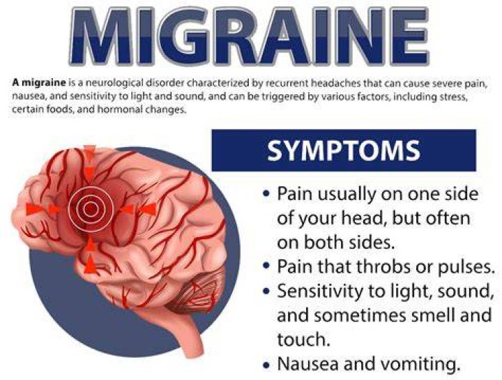 Does a neurologist treat migraine headache?