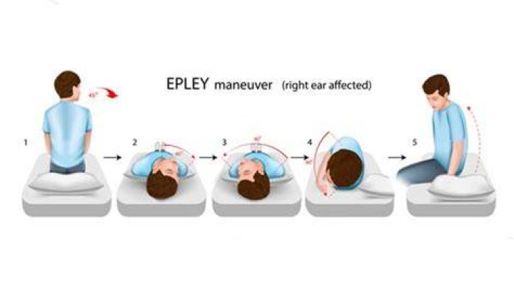 How do I know if the Epley maneuver worked?