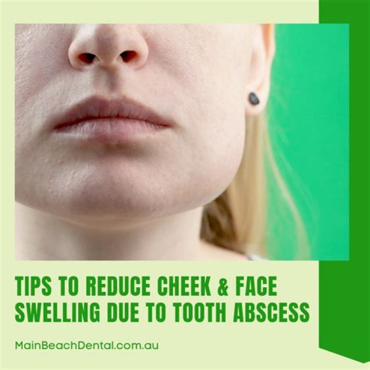 How long before abscess swelling goes down?