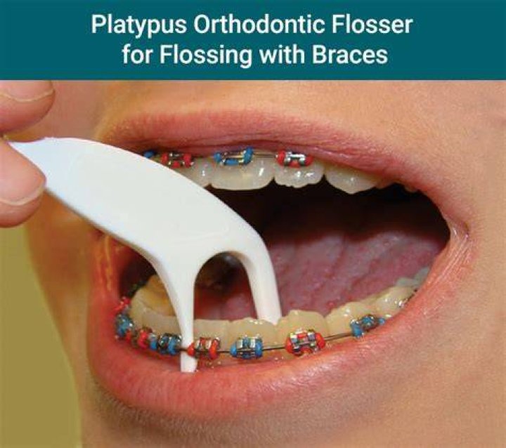Is it OK to use toothpick with braces?