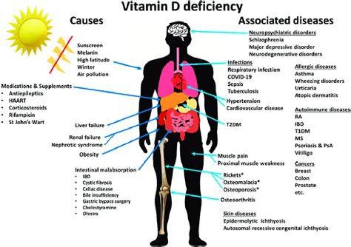 What happens if vitamin D deficiency is not treated?