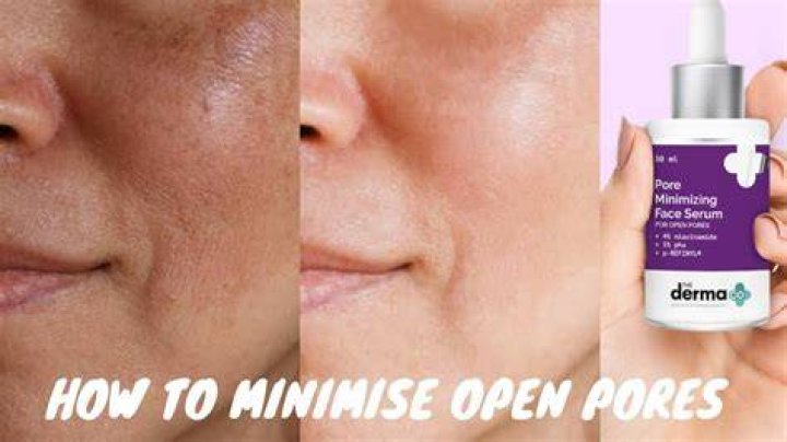 Which serum is good for open pores?