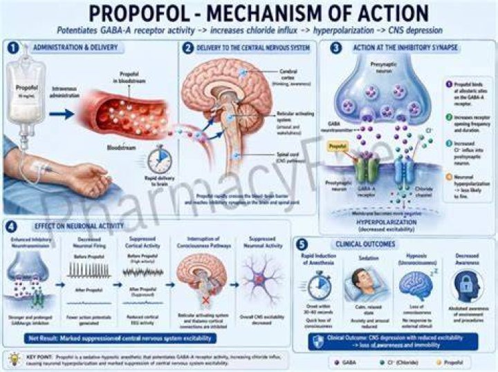 Why is propofol so good?
